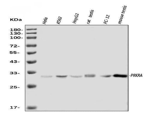 Anti-PRKRA Antibody Picoband® Boster Bio