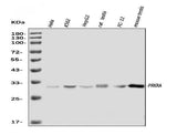 Anti-PRKRA Antibody Picoband® Boster Bio