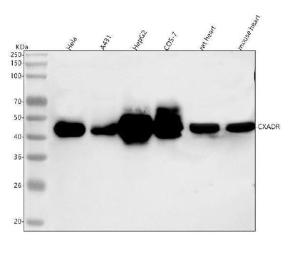 Anti-CXADR Antibody Picoband® Boster Bio