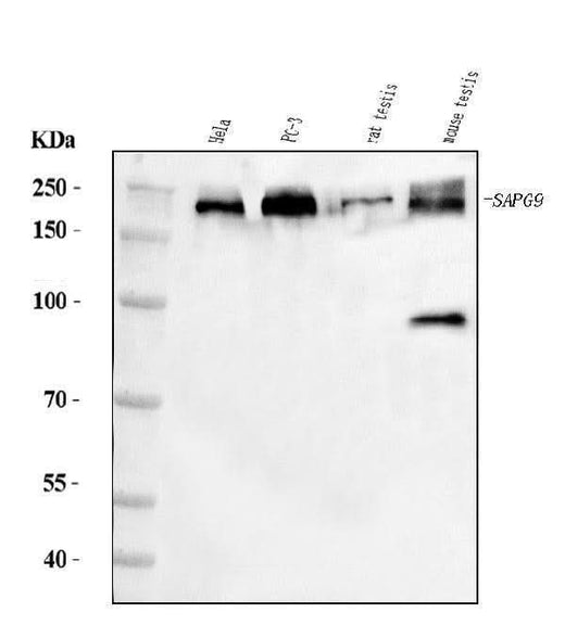 Anti-JLP/SPAG9 Antibody Picoband® Boster Bio