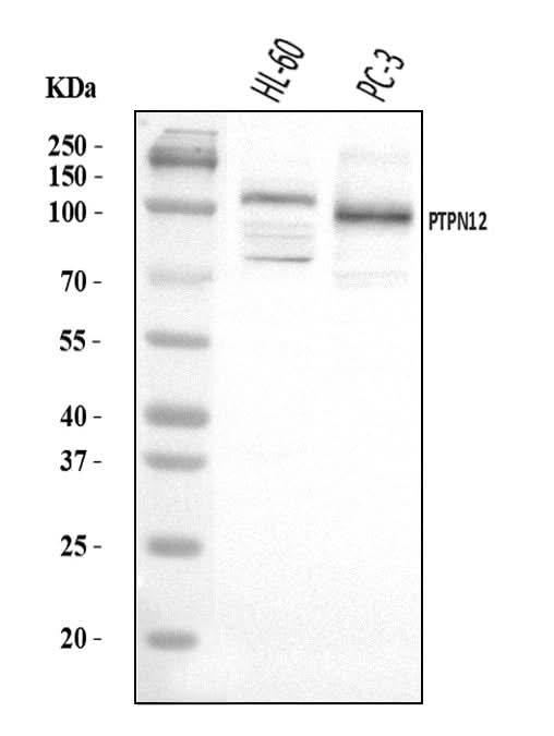 Anti-PTPN12 Antibody Picoband® Boster Bio