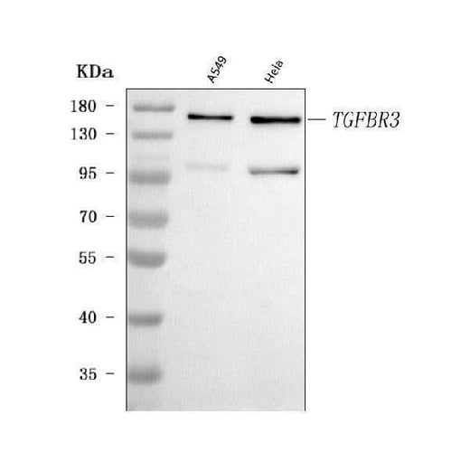 Anti-TGF beta Receptor III/TGFBR3 Antibody Picoband® Boster Bio