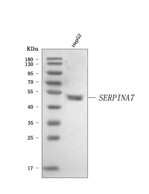 Anti-Thyroxine Binding Globulin/SERPINA7 Antibody Picoband® Boster Bio