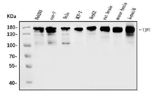 Anti-TJP2/ZO2 Antibody Picoband® Boster Bio