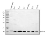 Anti-S100A10 Antibody Picoband® Boster Bio