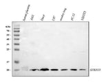 Anti-S100A10 Antibody Picoband® Boster Bio