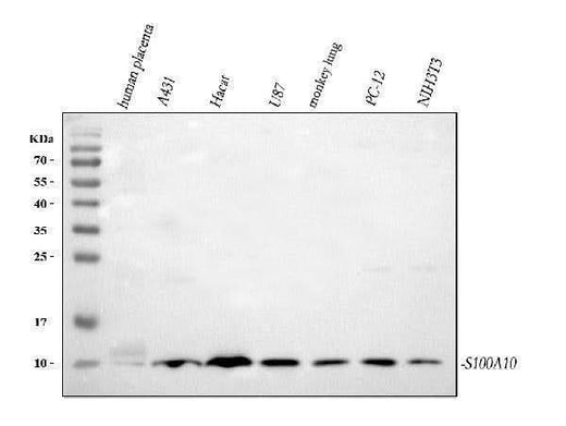 Anti-S100A10 Antibody Picoband® Boster Bio
