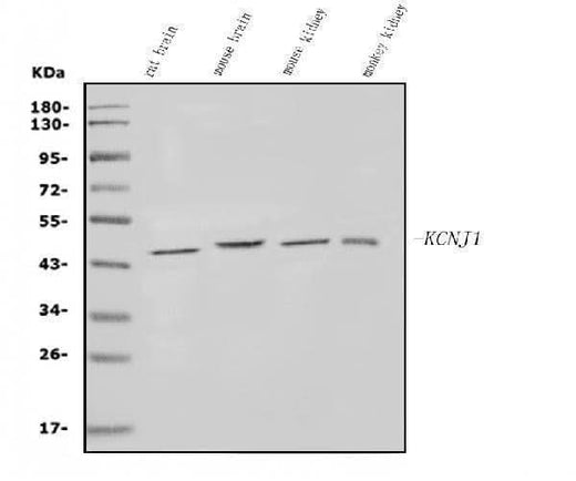 Anti-KCNJ1 Antibody Picoband® Boster Bio
