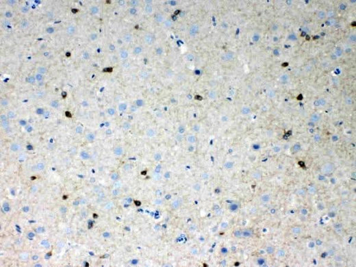 Anti-HCN2 Antibody Picoband® Boster Bio