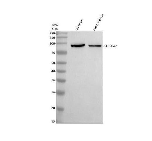 Anti-SLC20A2 Antibody Picoband® Boster Bio