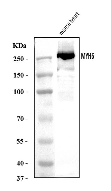 Anti-MYH6 Antibody Picoband® Boster Bio