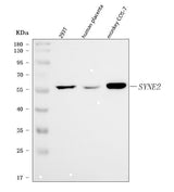 Anti-Nesprin 2/SYNE2 Antibody Picoband® Boster Bio