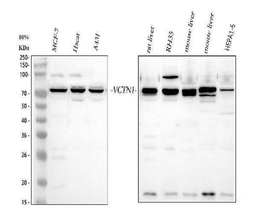 Anti-B7H4/VTCN1 Antibody Picoband® Boster Bio
