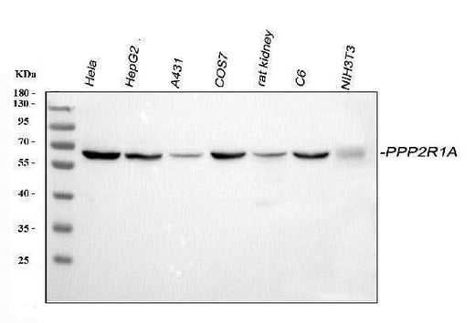 Anti-PPP2R1A Antibody Picoband® Boster Bio