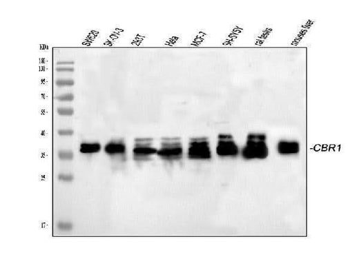 Anti-CBR1 Picoband® Antibody Boster Bio