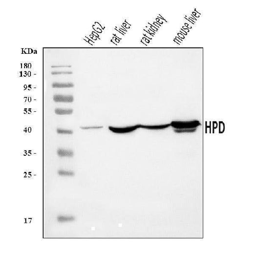 Anti-HPD Antibody Picoband® Boster Bio