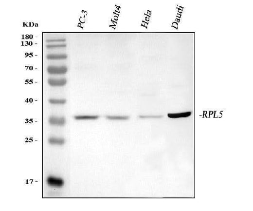Anti-RPL5 Antibody Picoband® Boster Bio
