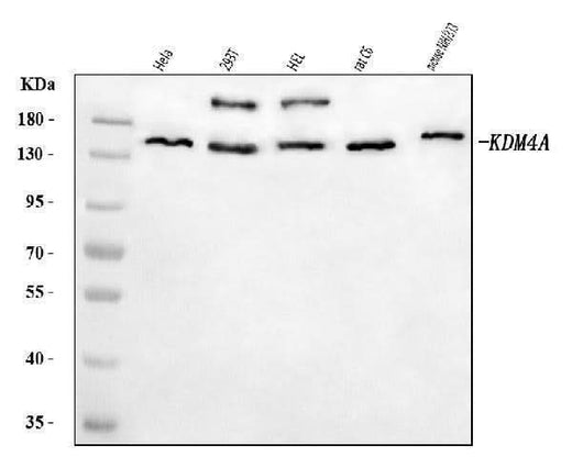 Anti-JHDM3A/JMJD2A/KDM4A Antibody Picoband® Boster Bio