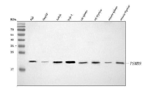 Anti-PSMB9 Antibody Picoband® Boster Bio