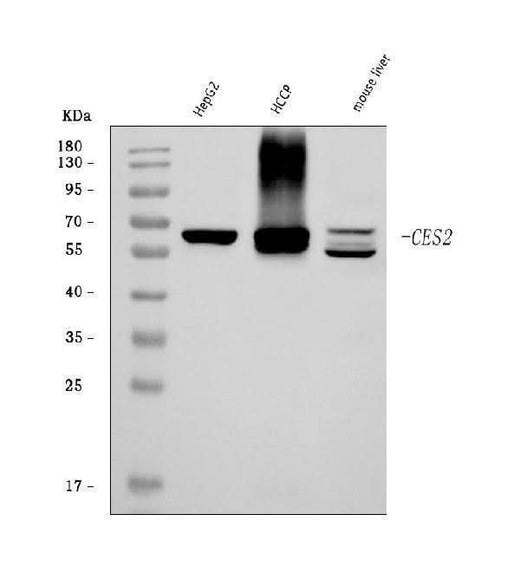 Anti-CES2 Antibody Picoband® Boster Bio