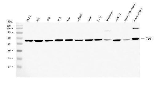 Anti-TRK fused gene/TFG Antibody Picoband® Boster Bio