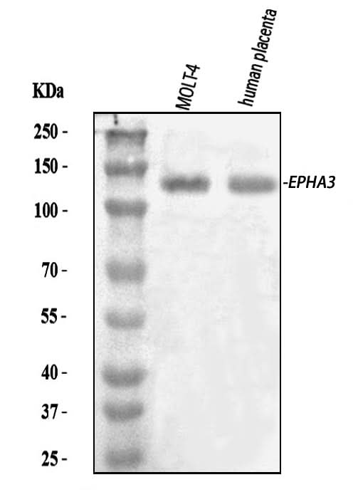 Anti-Eph receptor A3/EPHA3 Antibody Picoband® Boster Bio