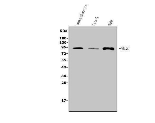 Anti-SOX6 Antibody Picoband® Boster Bio