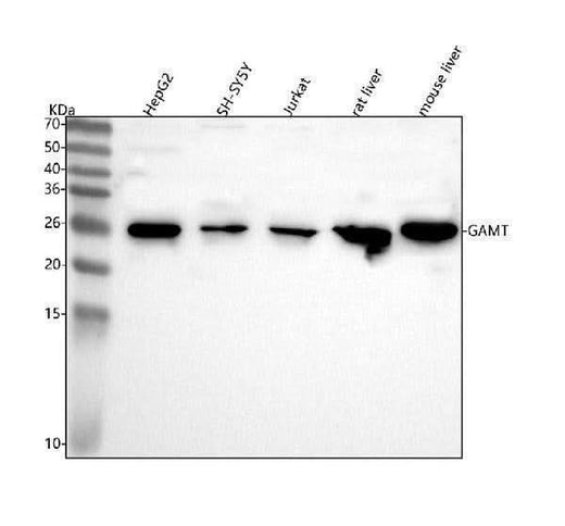 Anti-GAMT Antibody Picoband® Boster Bio
