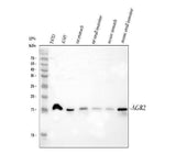 Anti-Anterior Gradient 2/AGR2 Antibody Picoband® Boster Bio
