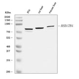 Anti-Hydroxysteroid (17-beta) Dehydrogenase 4/HSD17B4 Antibody Picoband® Boster Bio
