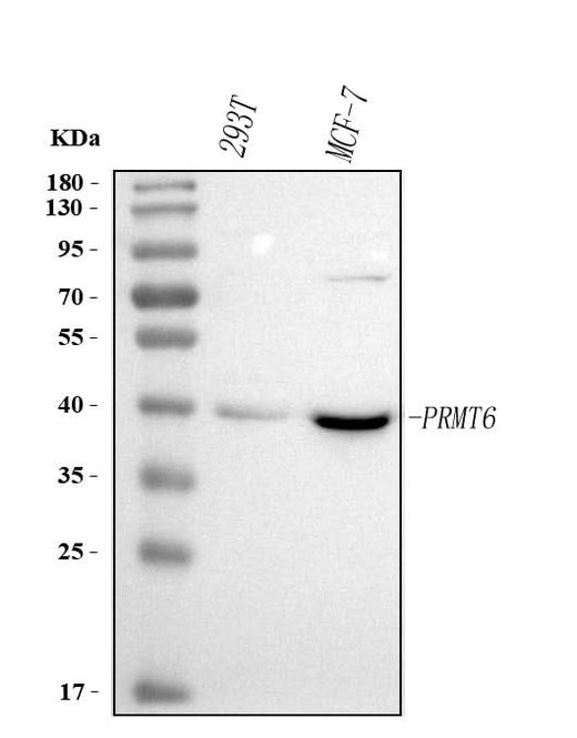 Anti-PRMT6 Antibody Picoband® Boster Bio