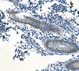 Anti-PPM1A Picoband® Antibody Boster Bio
