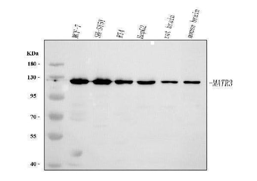 Anti-MATR3 Antibody Picoband® Boster Bio