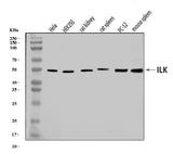 Anti-Integrin linked ILK Antibody Picoband® Boster Bio