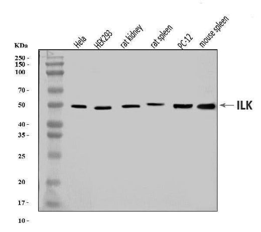 Anti-Integrin linked ILK Antibody Picoband® Boster Bio