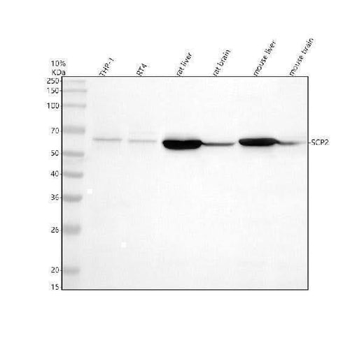 Anti-SCP2 Antibody Picoband® Boster Bio