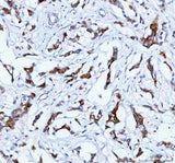 Anti-TACI/TNFRSF13B Antibody Boster Bio