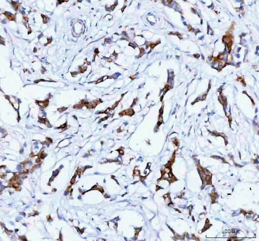 Anti-TACI/TNFRSF13B Antibody Boster Bio