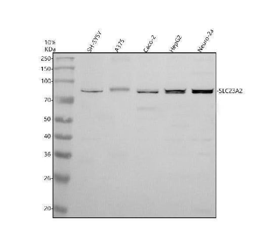 Anti-SVCT2/SLC23A2 Antibody Picoband® Boster Bio