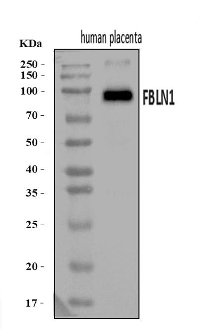 Anti-Fibulin 1/FBLN1 Antibody Picoband® Boster Bio