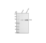 Anti-PYGM Antibody Picoband® Boster Bio