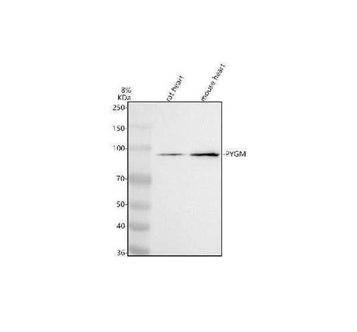 Anti-PYGM Antibody Picoband® Boster Bio