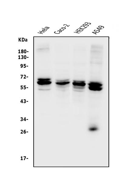Anti-CDR2 Antibody Picoband® Boster Bio