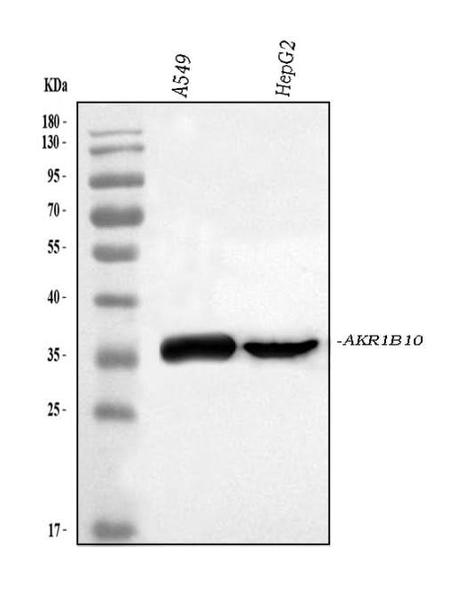 Anti-AKR1B10 Antibody Picoband® Boster Bio
