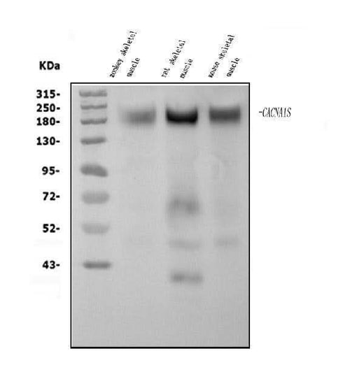 Anti-CACNA1S Antibody Picoband® Boster Bio