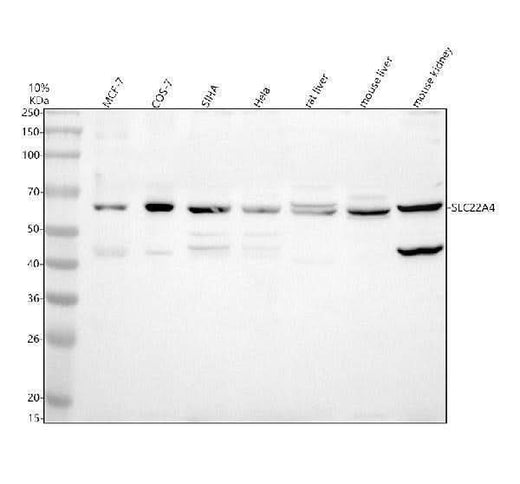 Anti-SLC22A4 Antibody Picoband® Boster Bio