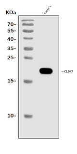 Anti-Claudin 2/CLDN2 Antibody Picoband® Boster Bio