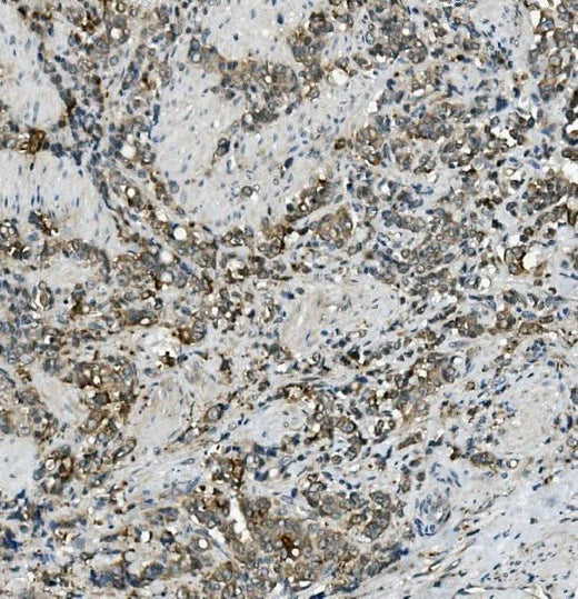 Anti-MRP5/ABCC5 Antibody Boster Bio