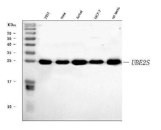 Anti-UBE2S Antibody Picoband® Boster Bio