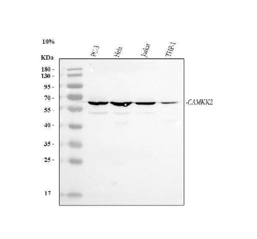Anti-CAMKK2 Antibody Picoband® Boster Bio